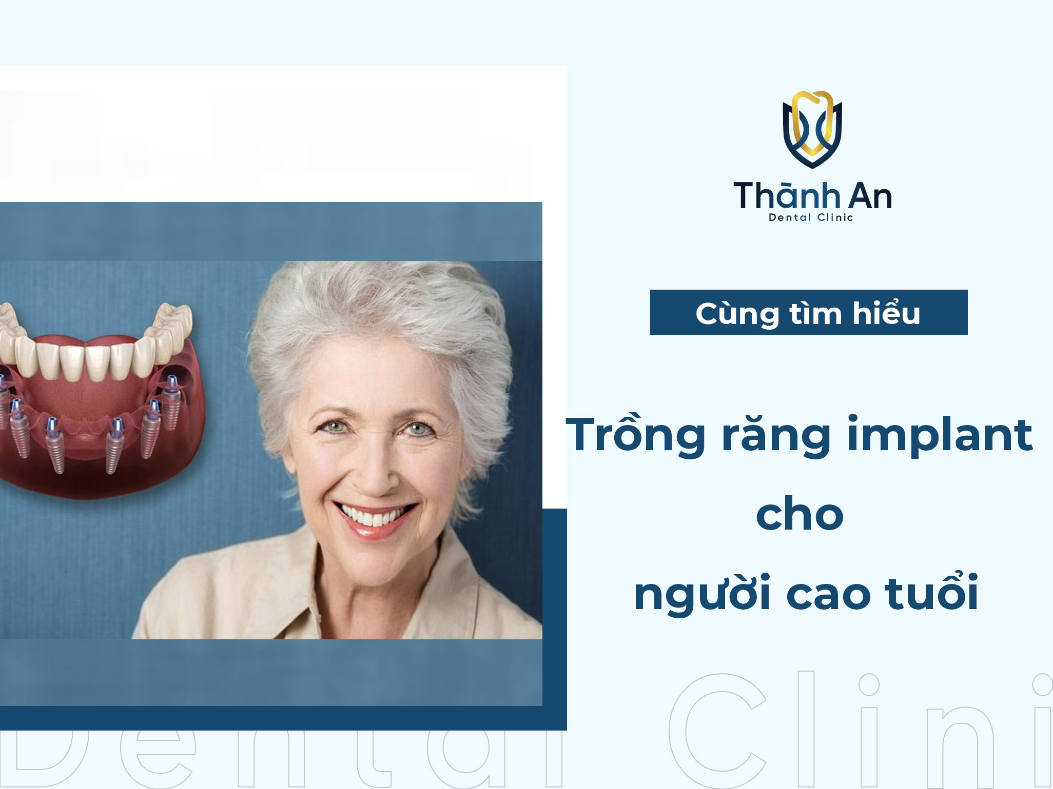 Nên trồng răng Implant cho người già không?