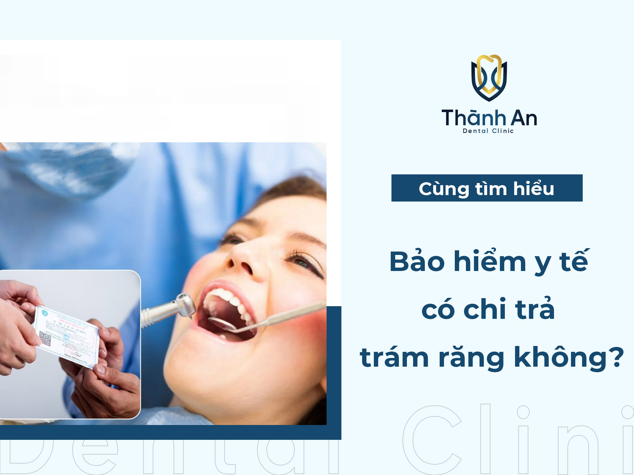 [Hỏi - Đáp] Bảo hiểm y tế có chi trả trám răng không?