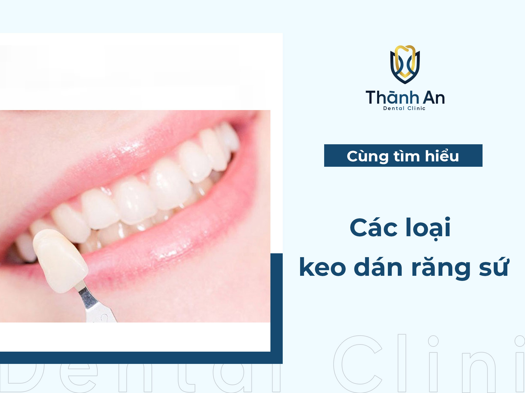 Keo dán răng sứ: Phân loại, Giá thành & Địa chỉ mua