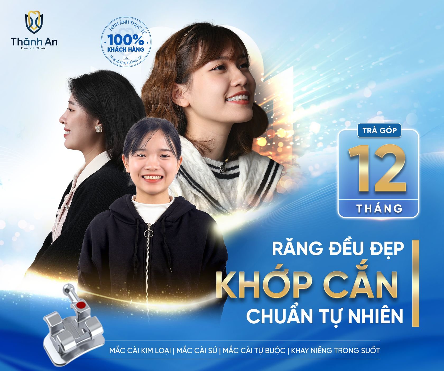 nha-khoa-thanh-an