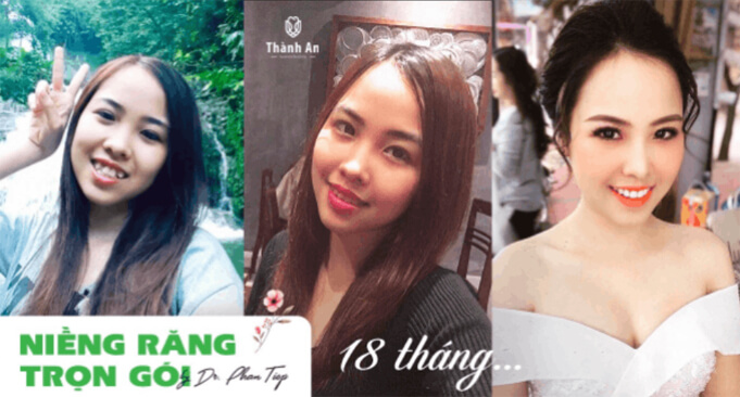 thanh-an
