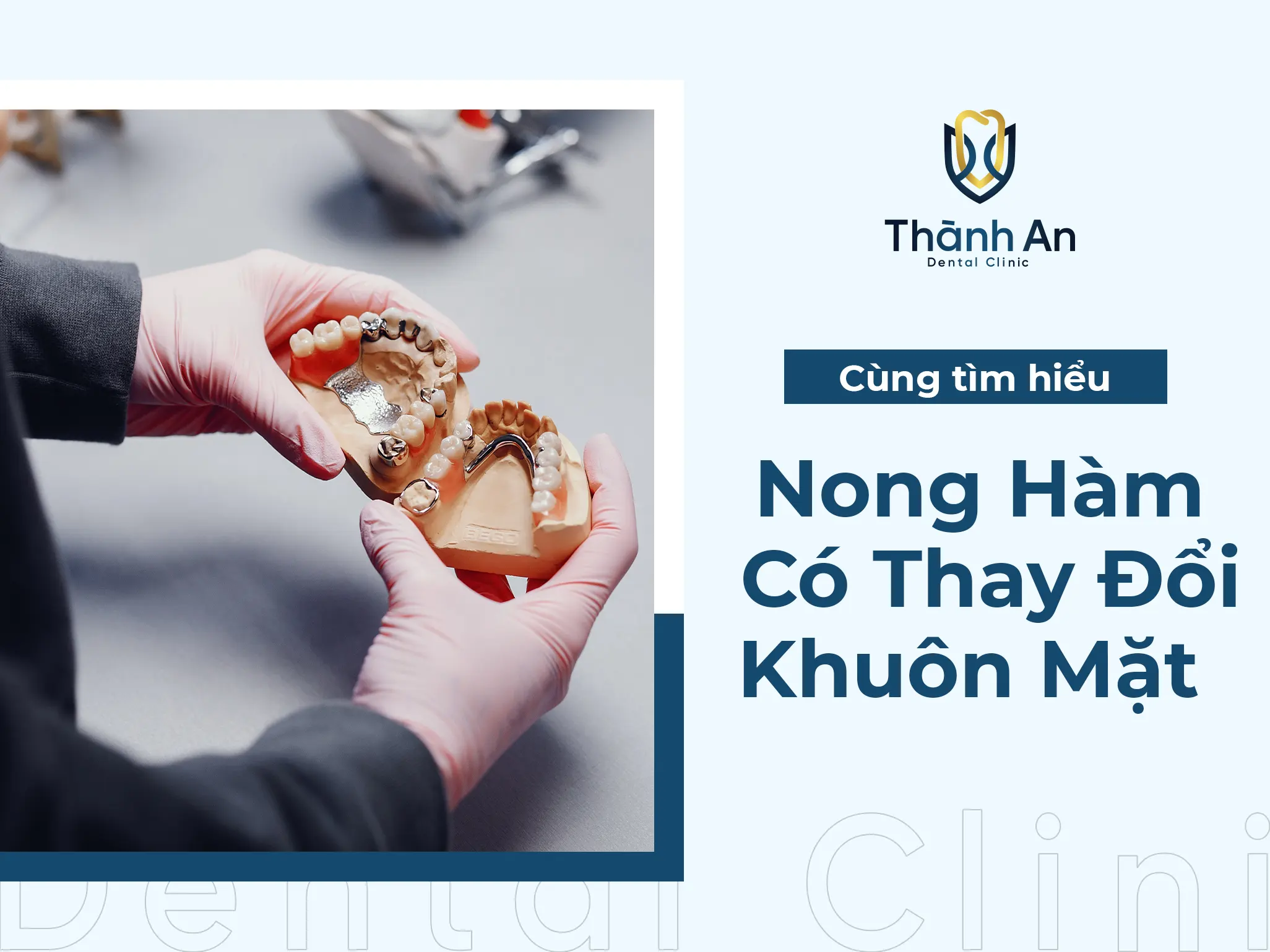 Nong Hàm Có Làm Thay Đổi Khuôn Mặt To Ra Hay Không?