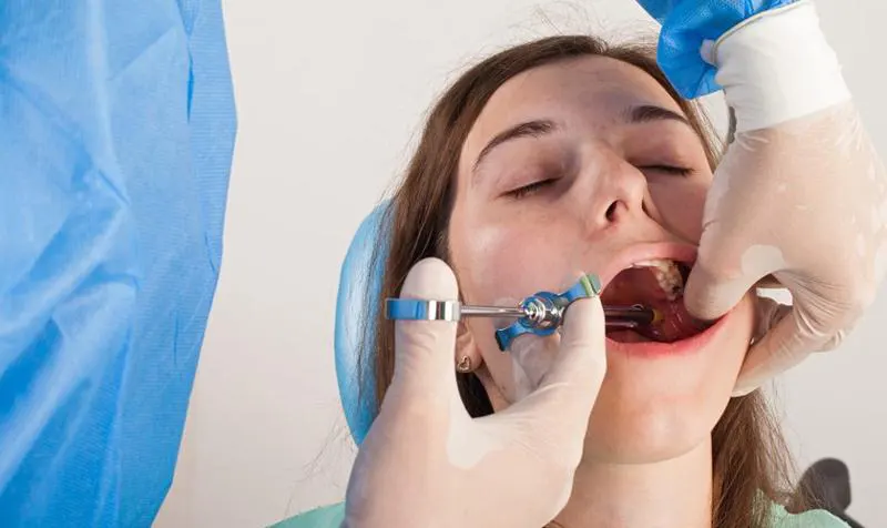 giá trồng răng implant