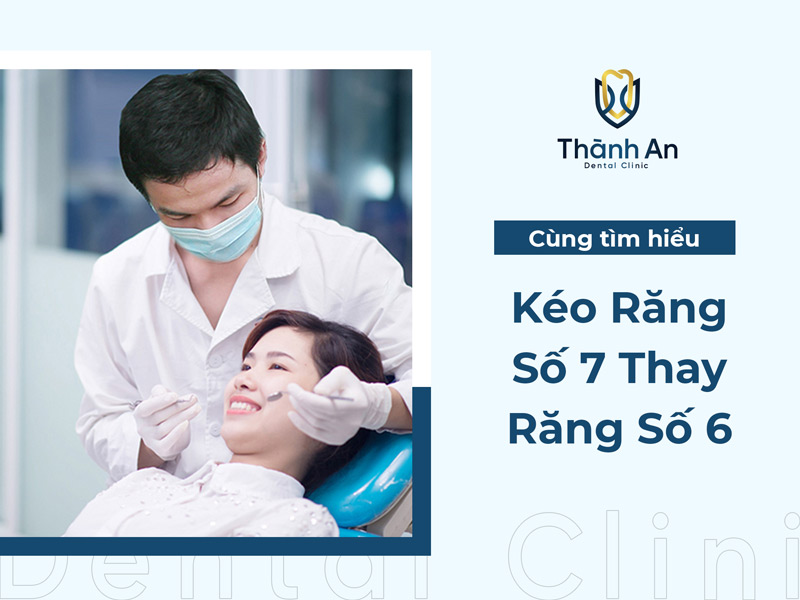 Có thể kéo răng số 7 thay răng số 6, số 8 thay số 7 không?