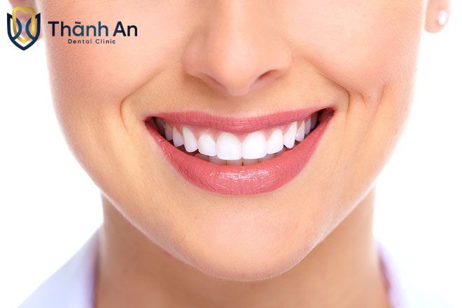 tẩy trắng răng giá bao nhiêu tiền